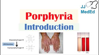 Introduction to Porphyria  Porphyria Cutanea Tarda vs Acute Intermittent Porphyria [upl. by Kucik]