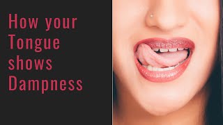 Dampness and your Tongue  Teeth marks coating what does it mean [upl. by Iretak]