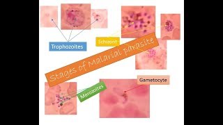 Malarial parasites identification within two minutes  Trophozoite Schizont Gametocyte Merozoite [upl. by Brendan384]