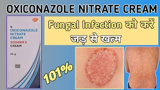 ZODERM E CREAM  Oxiconazole Nitrate cream uses dose side effect  Zoderm E cream review in hindi [upl. by Wylde]