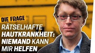 Seltene Krankheit Mein Leben ohne Heilung  Wie lebe ich mit einer schweren Krankheit Folge 7 [upl. by Hofstetter]