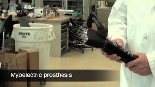 Prosthetist Career Spotlight [upl. by Joost]