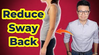 Correcting Swayback Posture And Why You Should Care [upl. by Klaus]