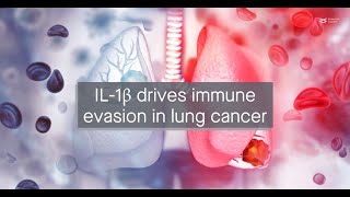 IL1β upregulates immune checkpoint regulators to promote immune evasion in lung adenocarcinoma [upl. by Gabriell940]