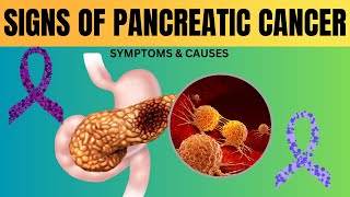 Pancreatic Cancer Causes amp Symptoms You Need to Know [upl. by Ramedlaw988]