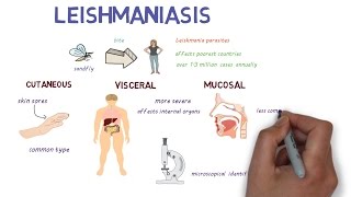 What is Leishmaniasis An introduction and overview [upl. by Royce874]