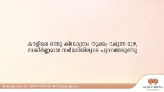 കരളിലെ രണ്ടു കിലോ തൂക്കം വരുന്ന മുഴ  സങ്കീർണ്ണമായ സർജറിയിലൂടെ പുറത്തെടുത്തു [upl. by Ninetta]