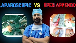 Laparoscopic vs open appendectomy l educationalvideo appendicitis surgeons jamui yt trending [upl. by Serdna]