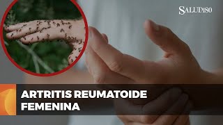 ✅ Entendiendo la ARTRITIS reumatoide en mujeres  Salud180 🌿 [upl. by Nabatse]