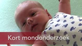 Kort mondonderzoek bij baby [upl. by Yirinec]