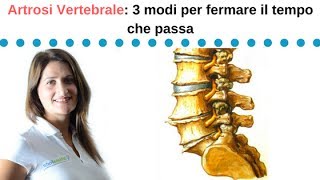 Artrosi vertebrale le 3 cose che devi sapere per fermare il tempo che passa [upl. by Arihday136]