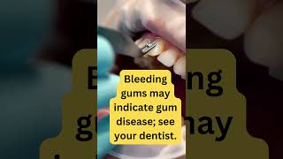 The Shocking Reason Your Gums Are Bleeding Every Morning [upl. by Normie]