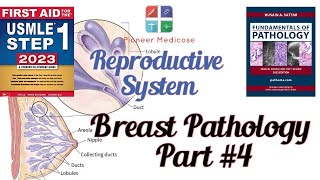 Breast pathologyCancer from Pathoma in urdu Part4 Reproductive system pathUrduHindi [upl. by Va]