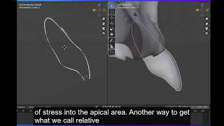 Tooth movement explained with an open source software [upl. by Oterol]