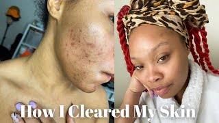 Skincare Routine For Hyperpigmentation amp Dark Spots  CeraVe [upl. by Shir602]