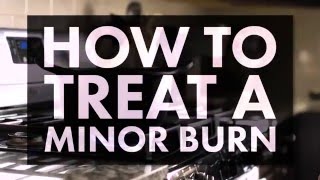 How to Treat a Minor Burn [upl. by Ioved]