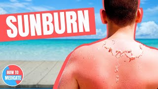 How To Treat A Sunburn [upl. by Indys41]