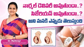 Myths And Facts About Normal Vs Cesarean Delivery  DrMythrayi  Mythri Sri Fertility Centre [upl. by Duthie]