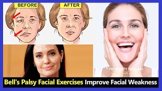 8 Best Facial Exercises for Bells Palsy improve your face weakness [upl. by Hort44]