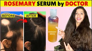 Miracle Best Rosemary hair serum for hair growth at home  Rosemary Serum for Hair Growth by Doctor [upl. by Ecneralc]