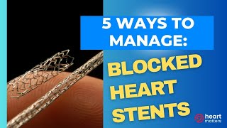 5 ways to manage blocked heart stents [upl. by Lyndel]