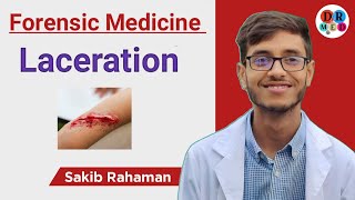 Laceration  Lacerated incised looking wound  Forensic medicine amp toxicology bangla lecture [upl. by Ellenaj]