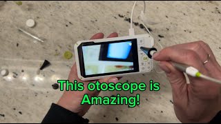 Anykit Digital Otoscope with Gyroscope Review [upl. by Doy]