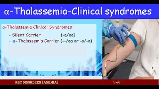 Lecture 251 Carriers alfa Thalassemia  Clinical Syndromes [upl. by Aiciles739]