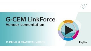 Veneer cementation with the resin cement G CEM LinkForce [upl. by Gold]