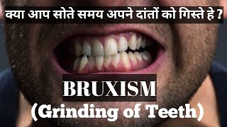 Bruxism or Grinding of Teeth Symptoms Causes and Treatment  How do you fix bruxism [upl. by Rianna]