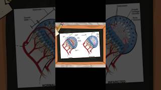 Pathophysiology of Legg Calve Perthes Disease perthes ortholectures orthopaedics orthodoc ortho [upl. by Anoed]