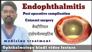 endophthalmitis  endophthalmitis treatment  endophthalmitis  endophthalmitis disease [upl. by Aserehc]