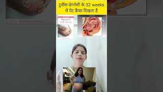 Twins pregnancy ke 32 weeks me pet kaisa dikhta hai belly in 32 weeks twins pregnancy in hindi [upl. by Lebam509]