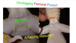 How To Unclog Femoral Pores [upl. by Kendricks]