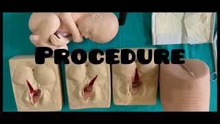 Episiotomy and PeriniotomyOBG [upl. by Rosamund]