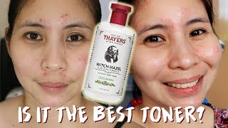 1 WEEK WITH THAYERS WITCH HAZEL TONER PH [upl. by Triley546]