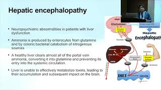 BRiCC 2023 Complications of DCLD Approach to patient  Upper GI bleeding amp Guidelines  Dr Nithya [upl. by Enninaej]