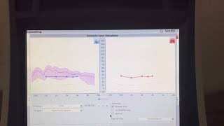 Verifit hearing simulation and Speech Intelligibility Index scores [upl. by Ahsael604]