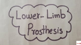 Lower Limb ProsthesisTypes Of Lower Limb ProsthesisImmediate PostOperative Prosthesis [upl. by Yecaj20]