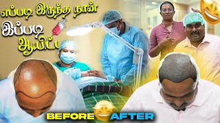 சம்பத்கான் கு முடி நட்டாச்சு  Hair Plantation  WFT Vlog [upl. by Antrim]