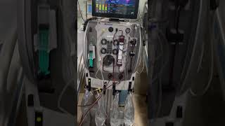 CRRT sabse mahangi dialysis Continuous Renal Replacement Therapy hospital [upl. by Oys]