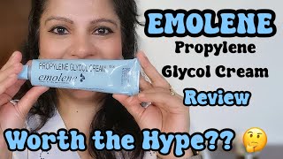 EMOLENE PROPLYLENE GLYCOL CREAM REVIEW  WORTH THE HYPE [upl. by Lazos]