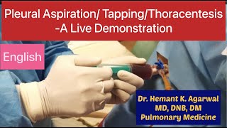 Pleural Aspiration Pleural Tapping Thoracentesis Needle Pleurocentesiss English [upl. by Garwin]