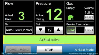 AirSeal In Service Module 6 AirSeal Mode Steps for Use in Primary Insufflation [upl. by Anelram]