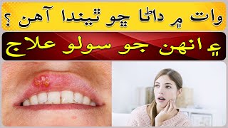 Why are there herpetic stomatitis in the mouth [upl. by Nimref]