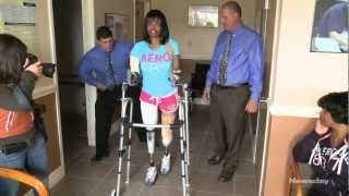 Amputee gets new arms and legs [upl. by Debbie]