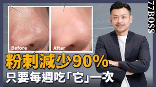 粉刺清不掉？痘痘一直長？吃『它』超有效，大幅降低粉刺發生率！【77老大】 [upl. by Gervase]