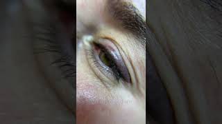 Before and After eyeliner tattoo Permanent makeup [upl. by Znerol208]