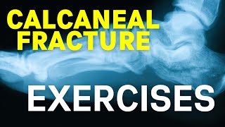 Calcaneal Fracture Exercises [upl. by Yonatan661]