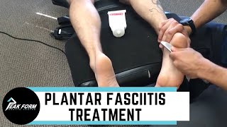 Plantar Fasciitis Treatment San Diego Graston Chiropractic [upl. by Duma]